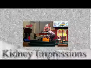 Kidney Impressions | Knoxville, TN | Balloon Twister | A Glimpse
